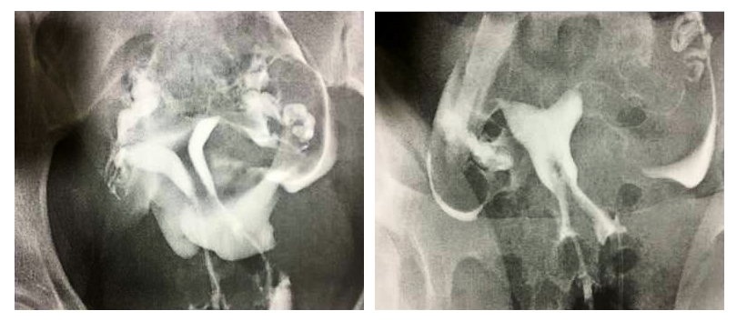 Tekrarlayan Gebelik Kayıpları - Prof. Dr. Engin Oral