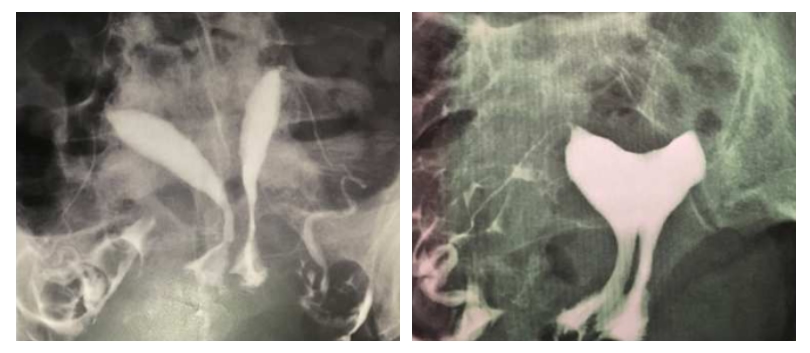 Tekrarlayan Gebelik Kayıpları - Prof. Dr. Engin Oral
